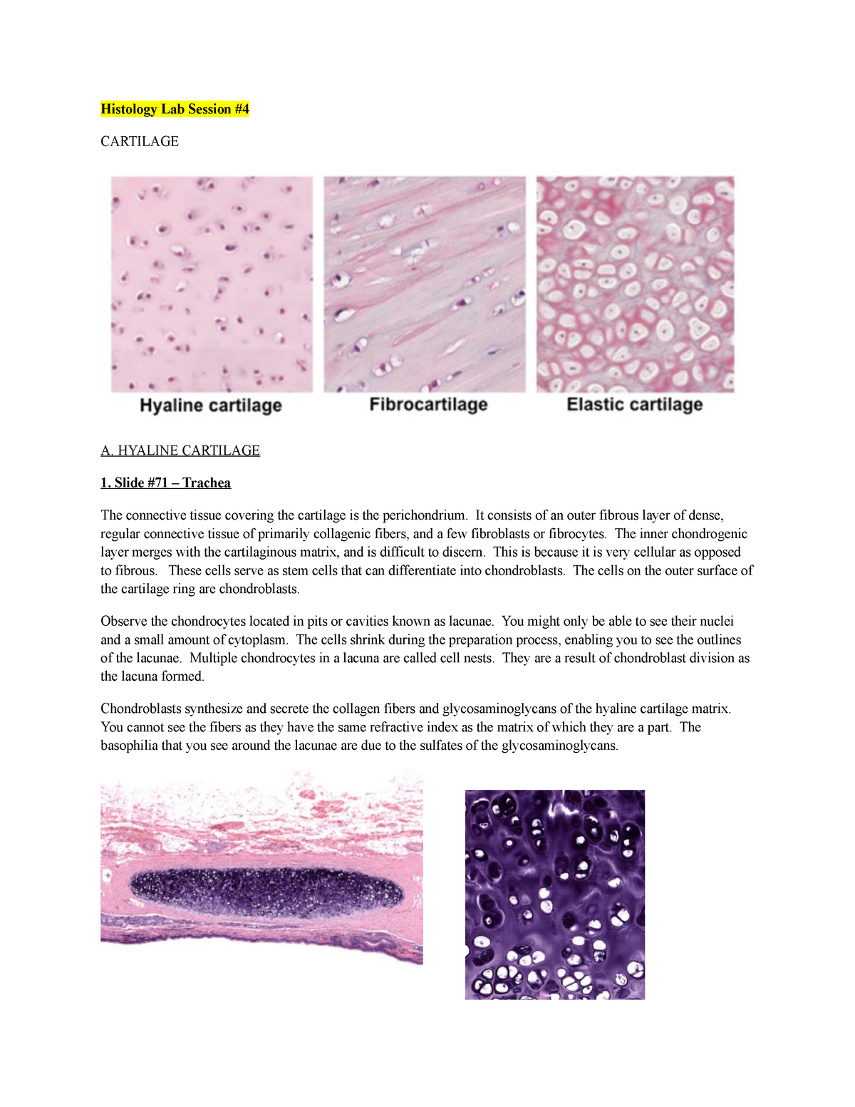 hyaline cartilage connective tissue trachea