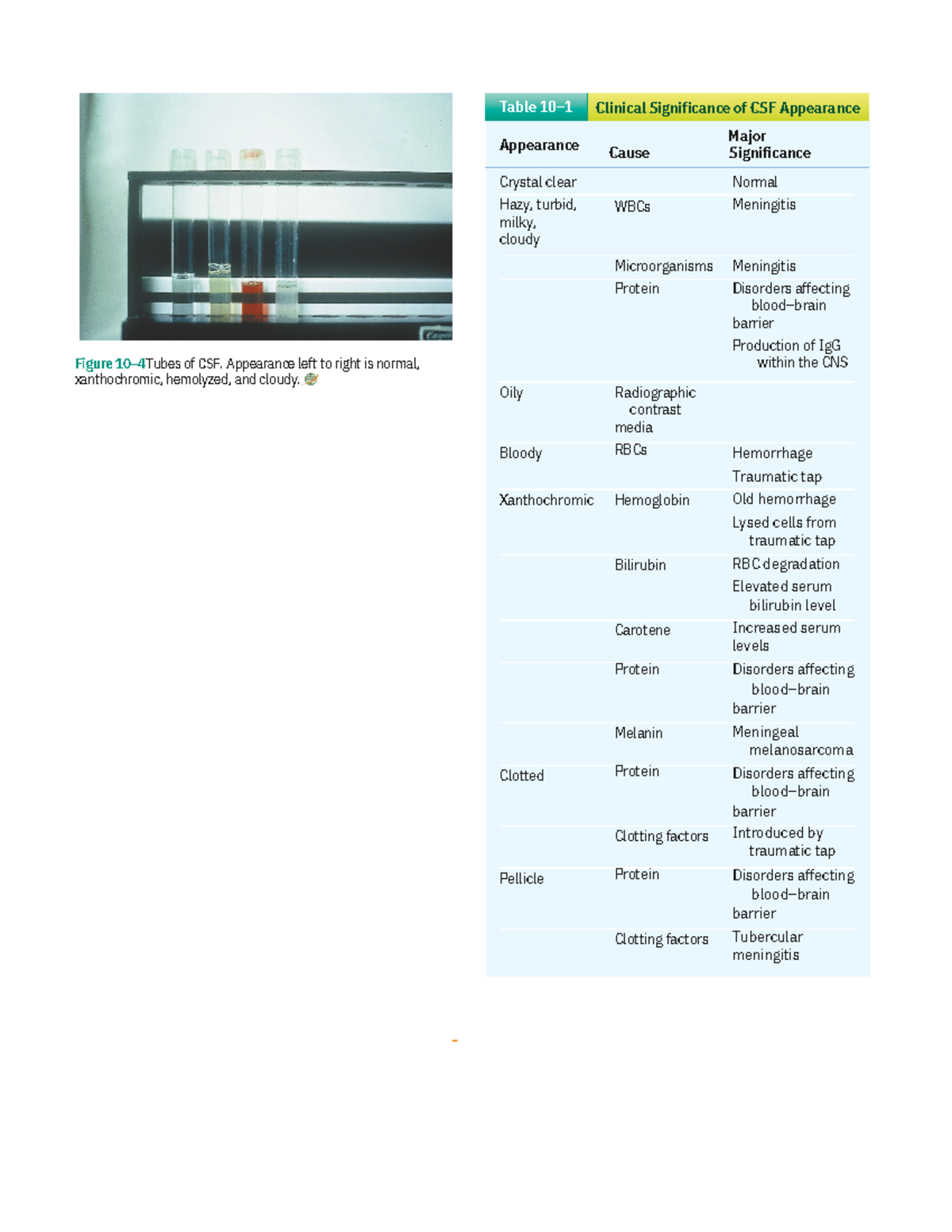 Analysis of Urine and Body Fluids Chapter 10 - Oily Bloody Pellicle ...