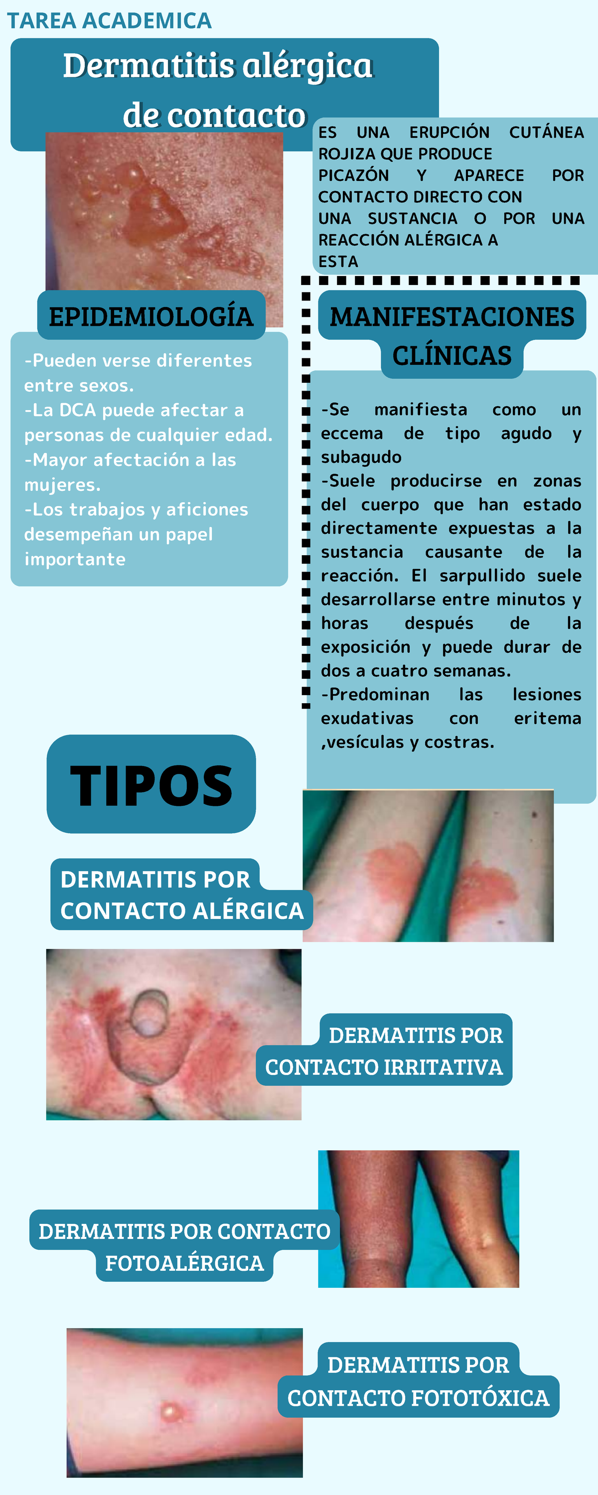 mecanismo de la dermatitis alérgica de contacto