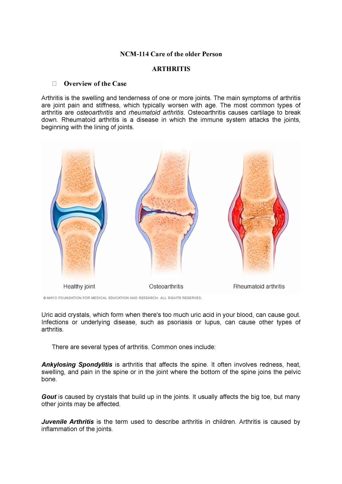 case study for arthritis