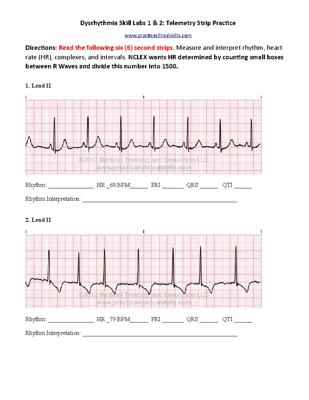 Dysrhythmia Skill Labs-Practice Strips - Dysrhythmia Skill Labs 1 & 2: Telemetry Strip Practice ...