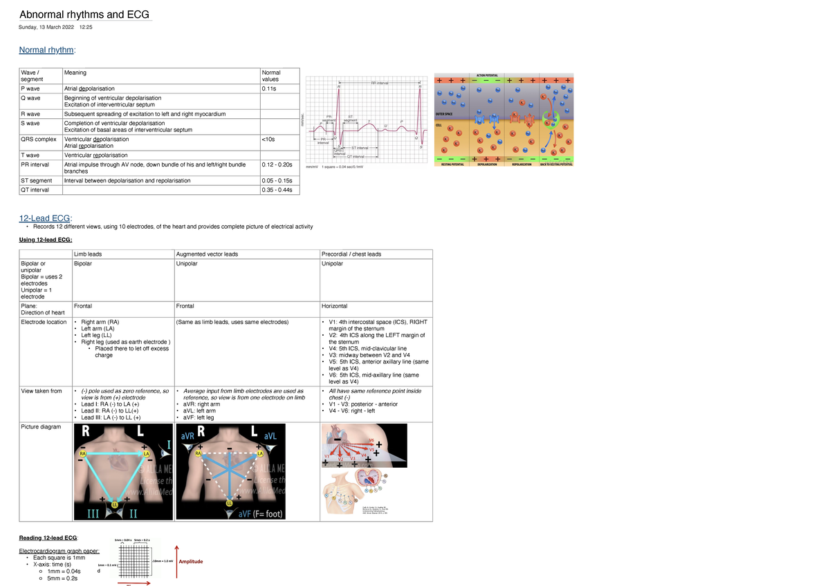 Abnormal rhythms and ECG - Abnormal rhythms and ECG Sunday, 13 March ...
