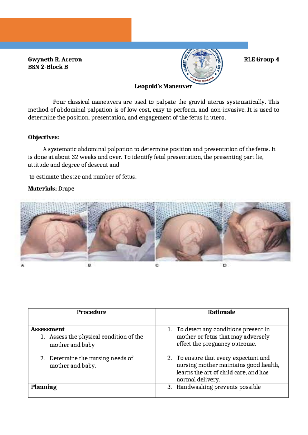 Chn leopold - Gwyneth R. Aceron RLE Group 4 BSN 2-Block B Leopold’s ...