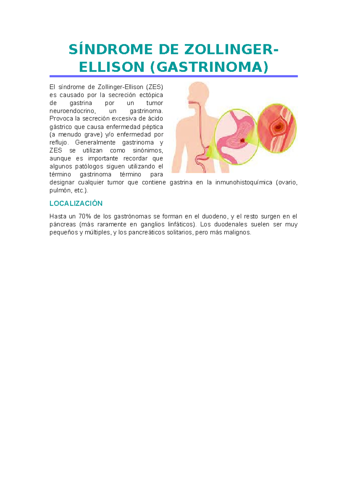 Síndrome DE Zollinger SÍNDROME DE ZOLLINGER ELLISON (GASTRINOMA) El