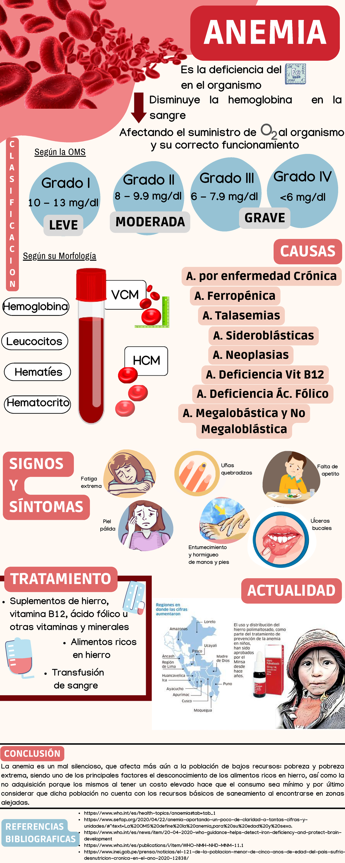 Infografia Anemia Completo Es La Deficiencia Del En El Organismo Anemia C L A S I F I C A C I 5226