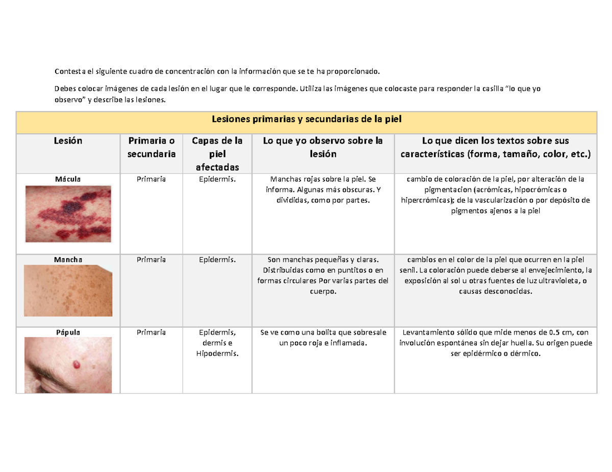 Lesiones Primarias Y Secundarias De La Piel - Contesta El Siguiente ...