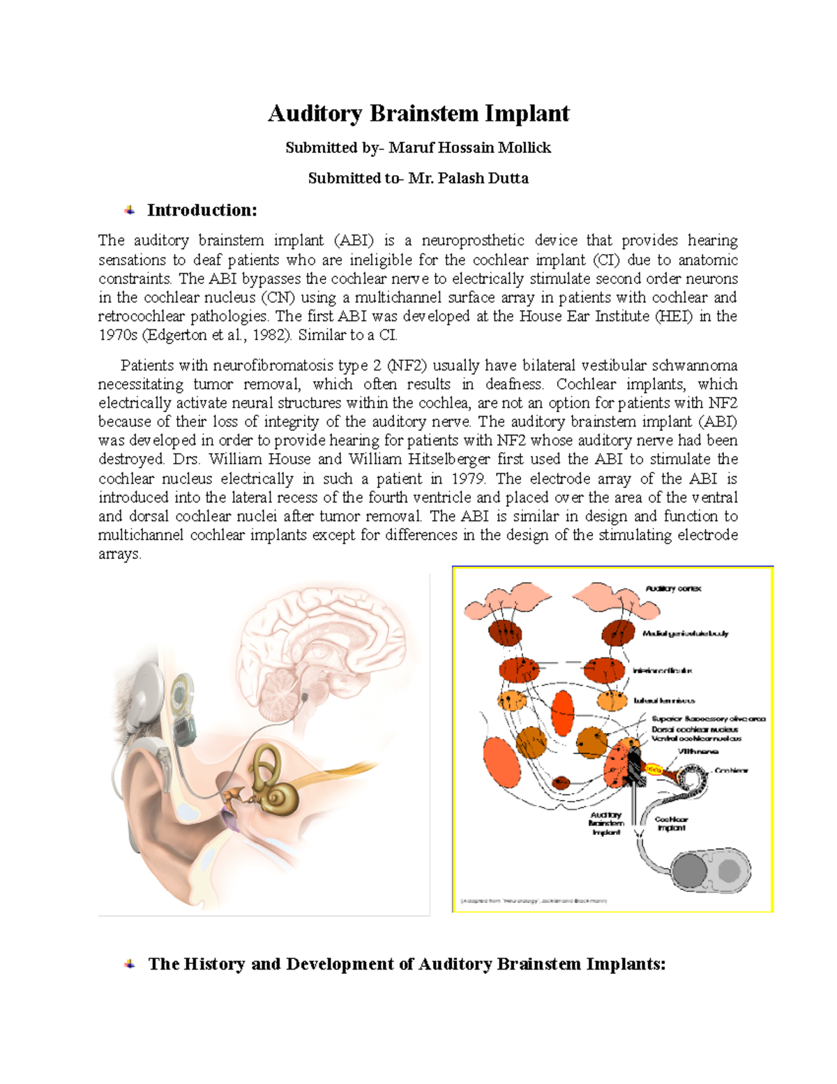 Abi - ON ABI - Auditory Brainstem Implant Submitted by- Maruf Hossain ...