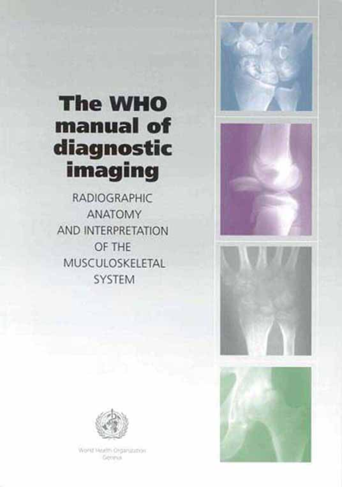 WHO radiology manual - The WHO manual of diagnostic imaging ...