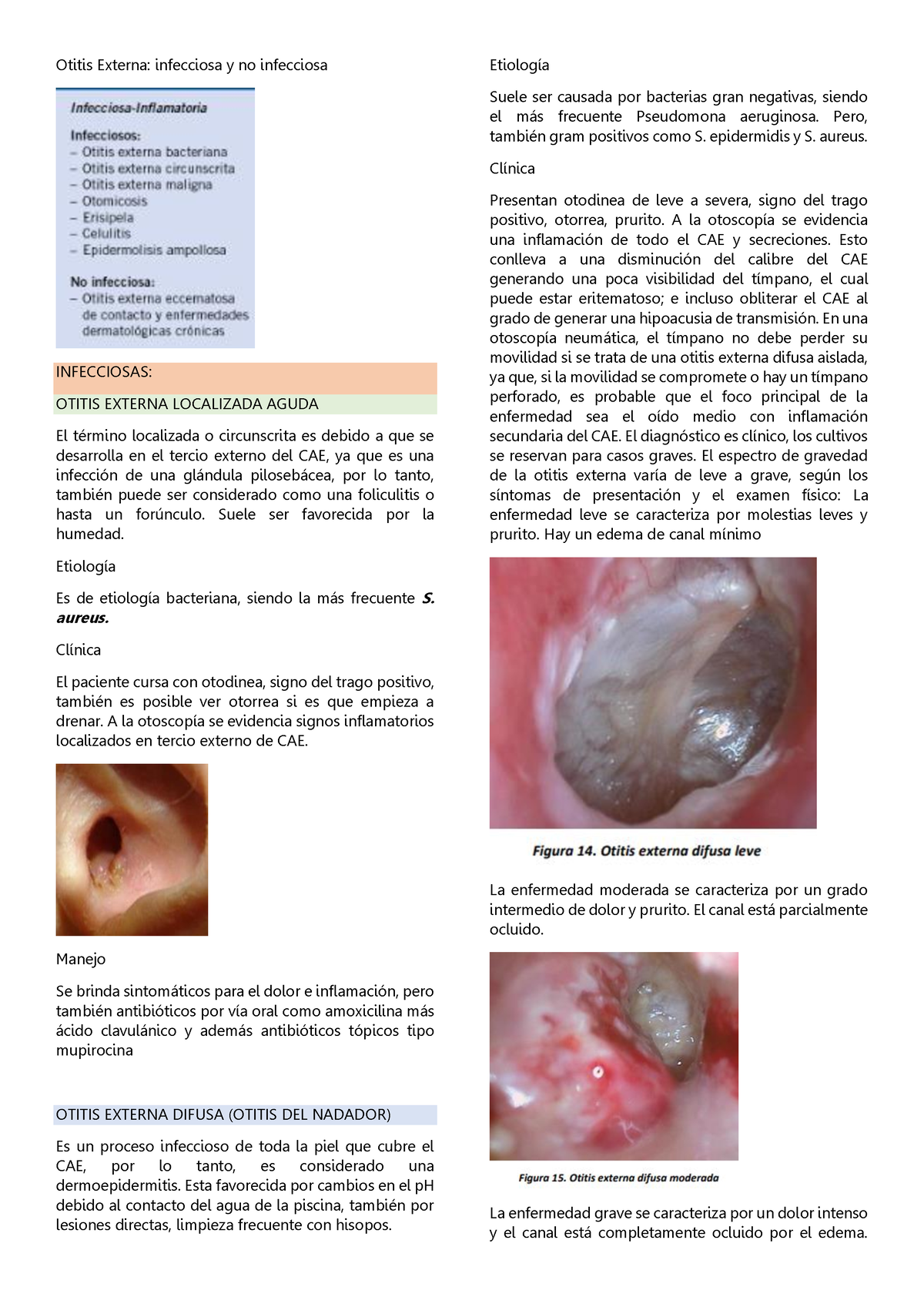 síntomas de otomicosis