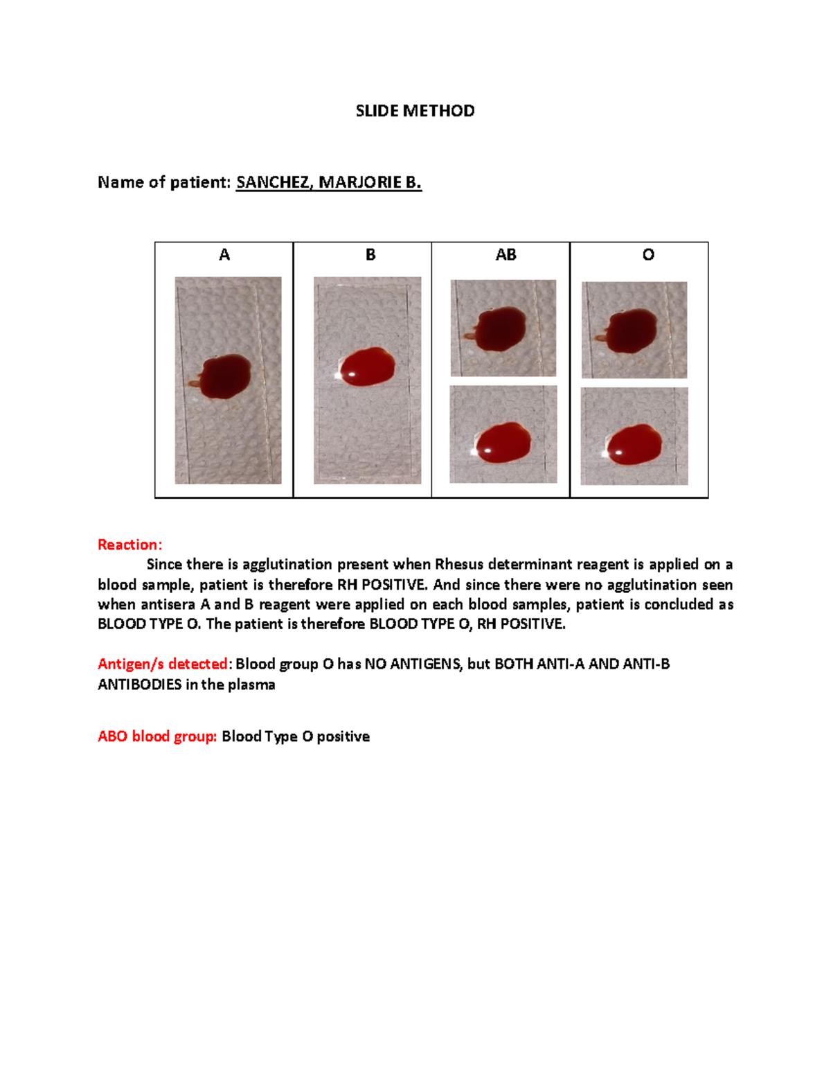 Activity 3- ABO Forward Typing - SLIDE METHOD Name of patient: SANCHEZ ...