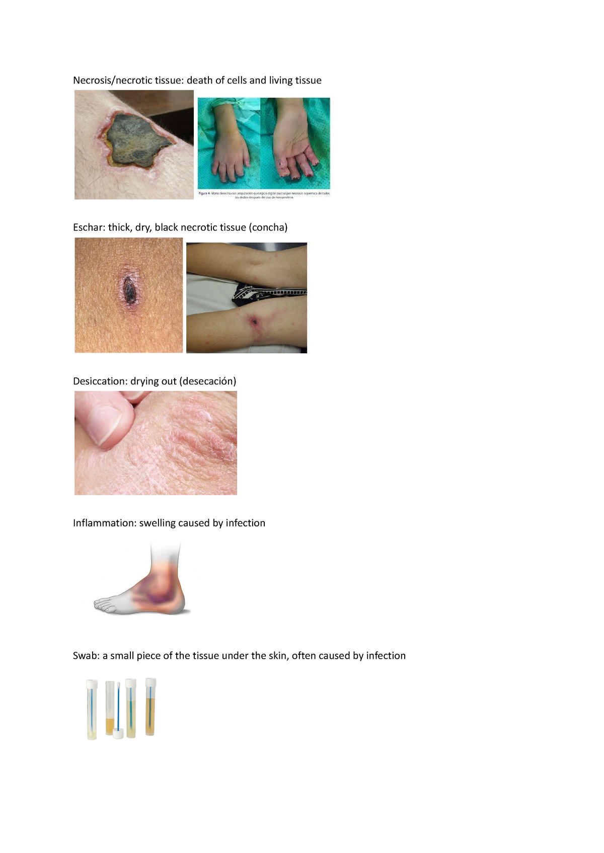 Vocabulario UNIT 3 - Necrosis/necrotic tissue: death of cells and ...