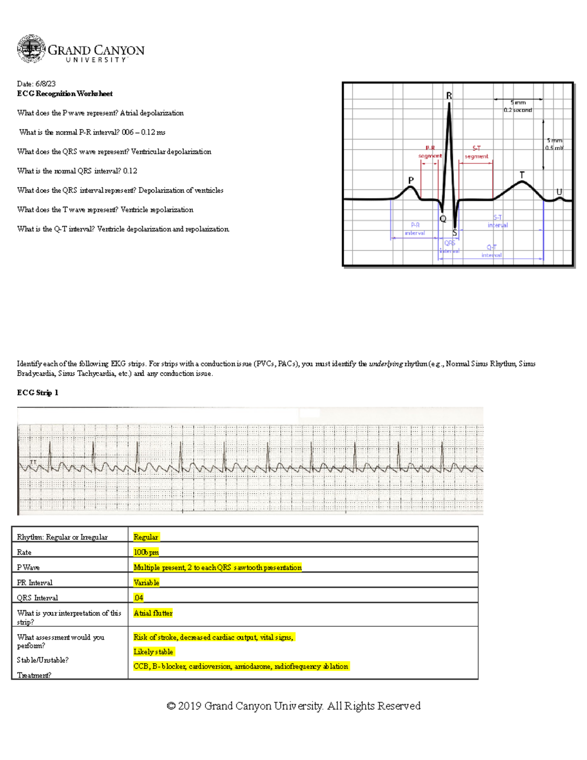 430 ECGRecognition - ECG worksheet - Date: 6/8/ ECG Recognition ...