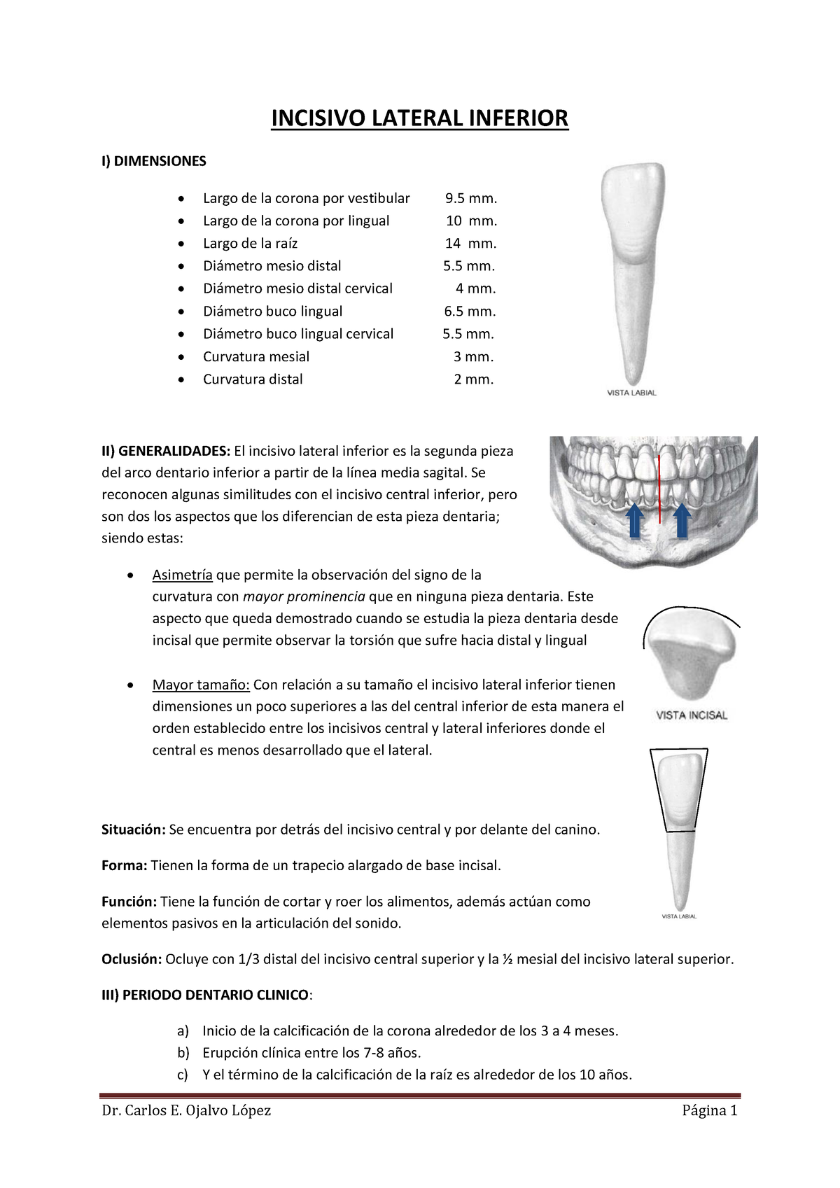 incisivo lateral