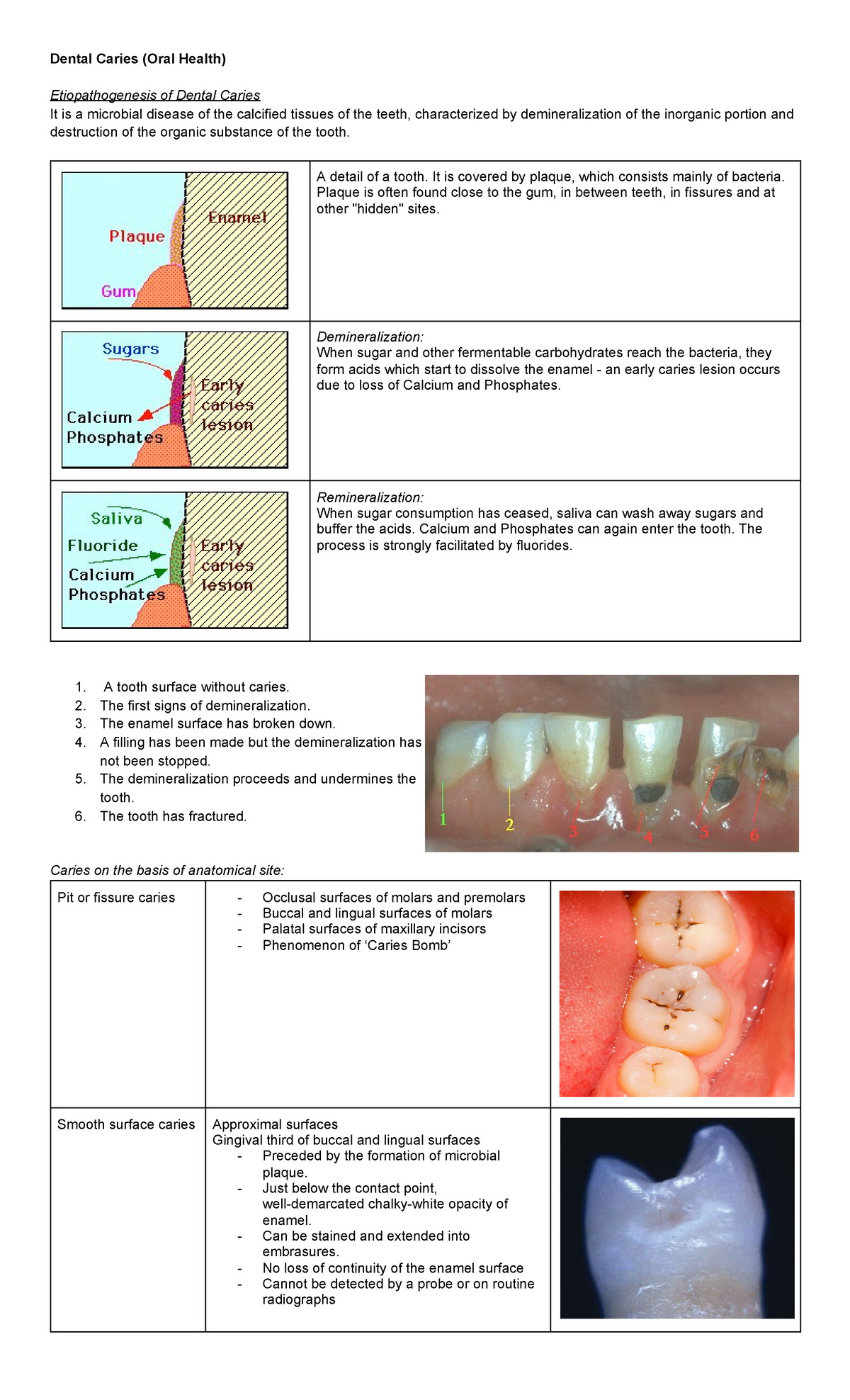 research articles on dental caries