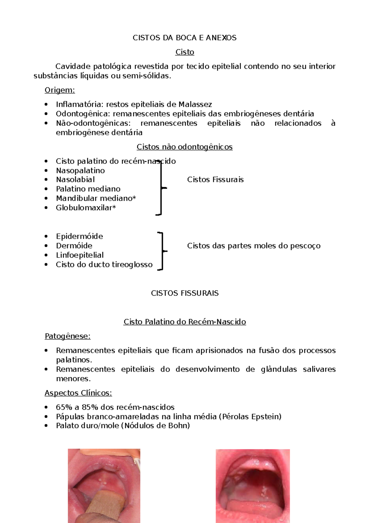 Cisto Linfoepitelial Oral - Patologia Bucal