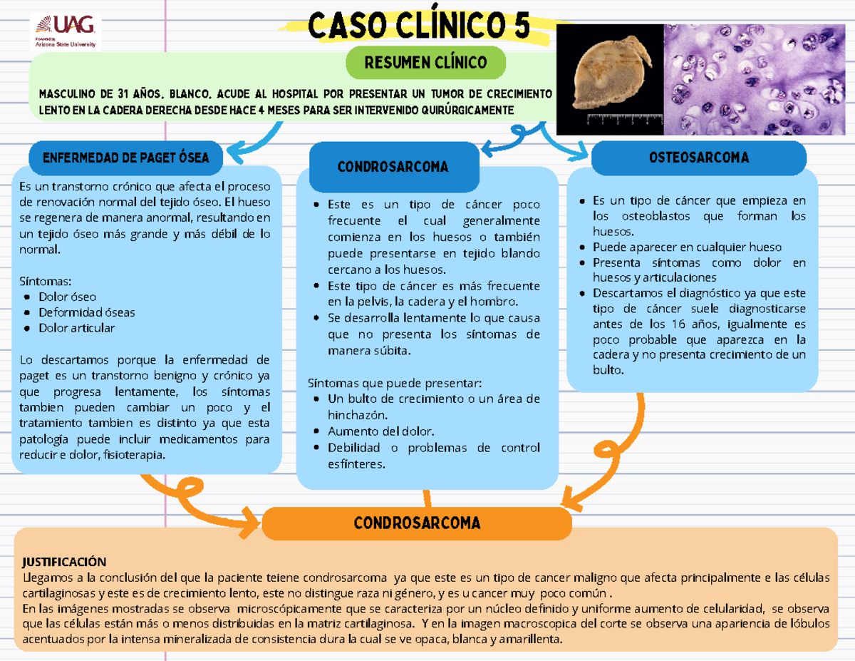 Caso clínico 5 - RESUMEN CLÍNICO CONDROSARCOMA ENFERMEDAD DE PAGET ÓSEA ...