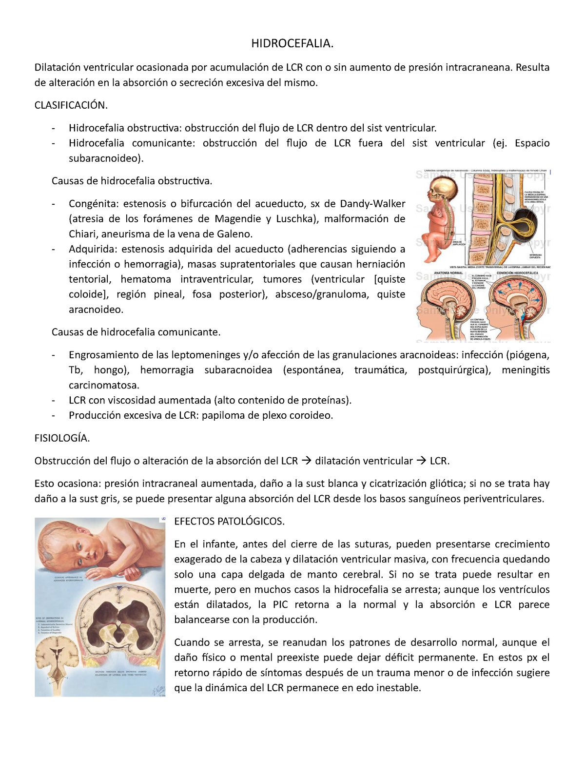 Hidrocefalia Hidrocefalia Dilatación Ventricular Ocasionada Por Acumulación De Lcr Con O Sin 3840