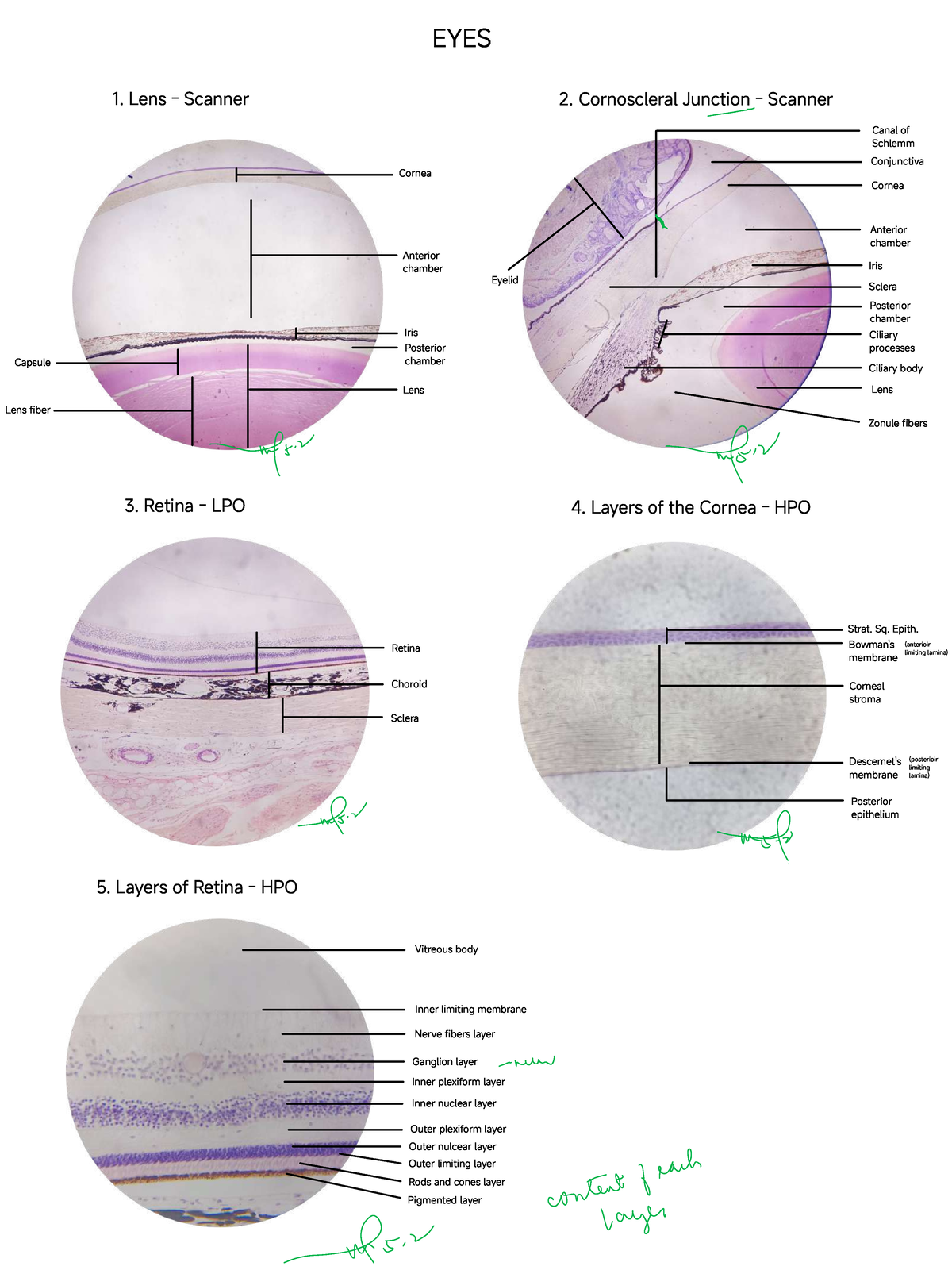 4th BM - Eyes & Ears Histology - EYES 1. Lens - Scanner 2. Cornoscleral ...