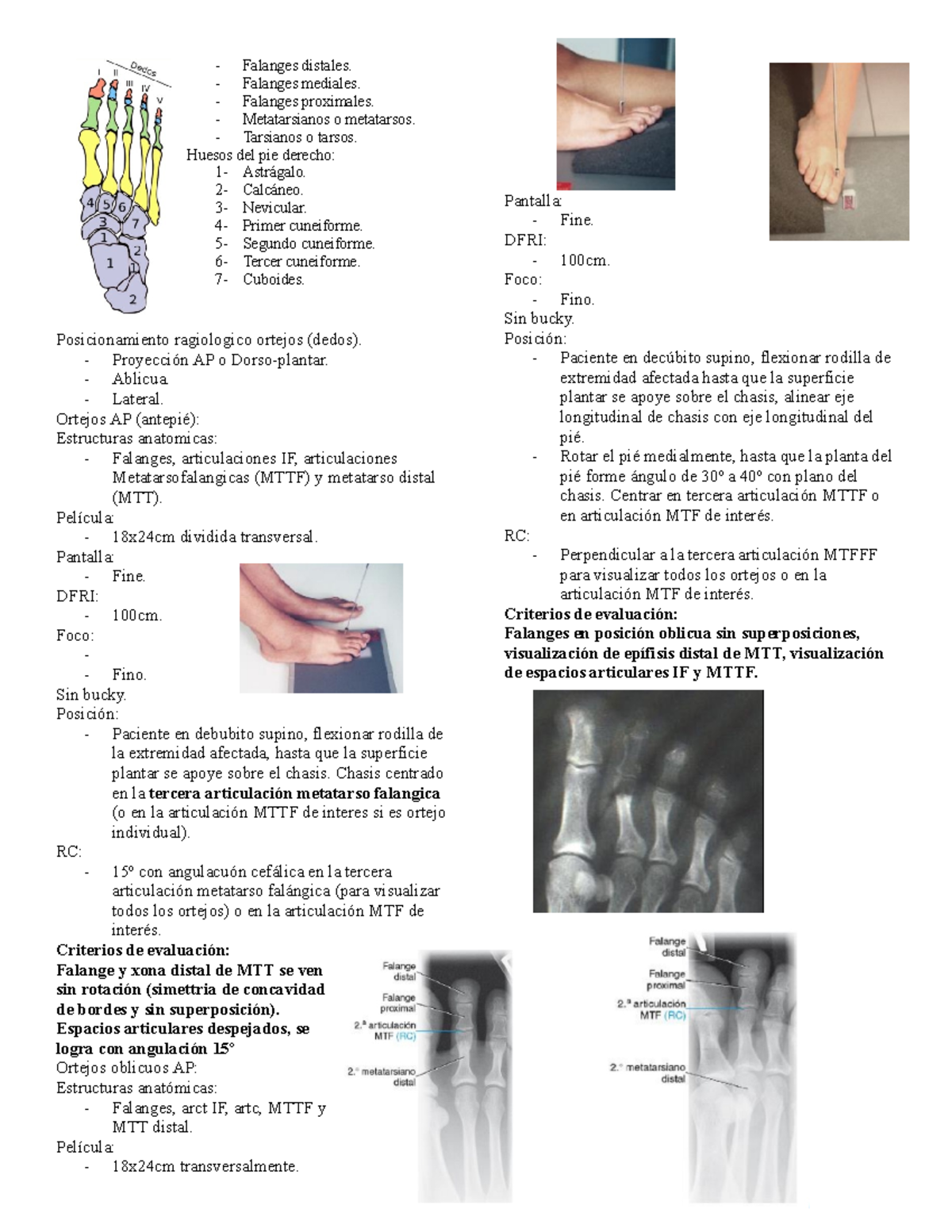 RX PIE - Apuntes de pie - Falanges distales. - Falanges mediales ...
