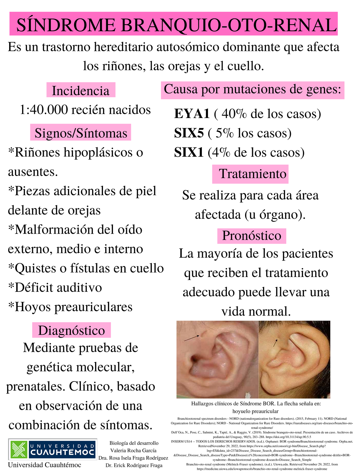 SÍ Ndrome Branqui-OTO- Renal 2 - Es un trastorno hereditario autosómico ...