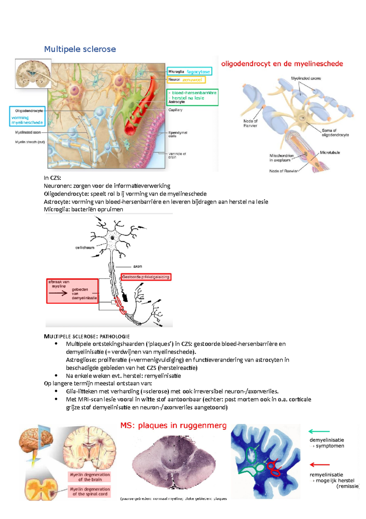 MS en Parkinson college 5,6,7[27] - Multipele sclerose In CZS: Neuronen ...