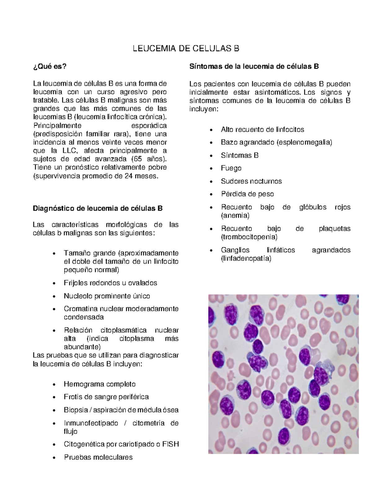 Leucemia DE Celulas B - LEUCEMIA DE CELULAS B ¿Qué Es? La Leucemia De ...