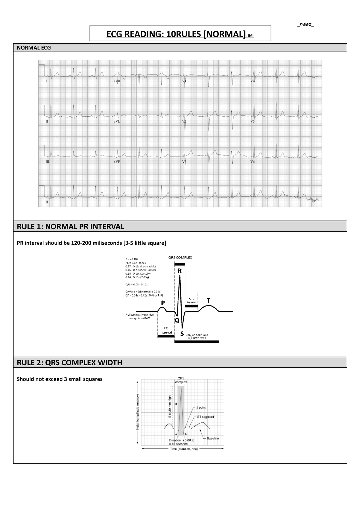 10rules-ecg-ten-rules-to-interpret-ecg-normal-ecg-rule-1-normal-pr