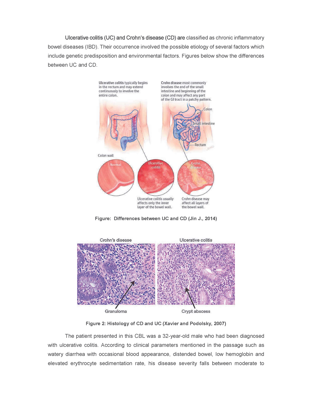 UC - Strictly No Copying. - Classified As Chronic Inflammatory Bowel ...