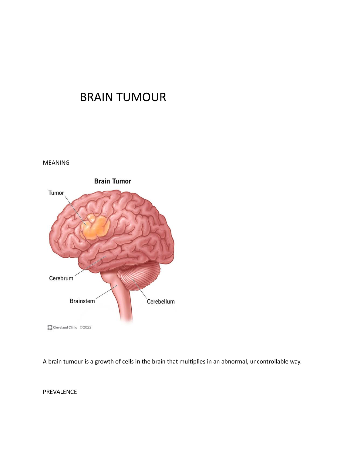 benign-tumour-what-is-benign-tumour-meaning-youtube