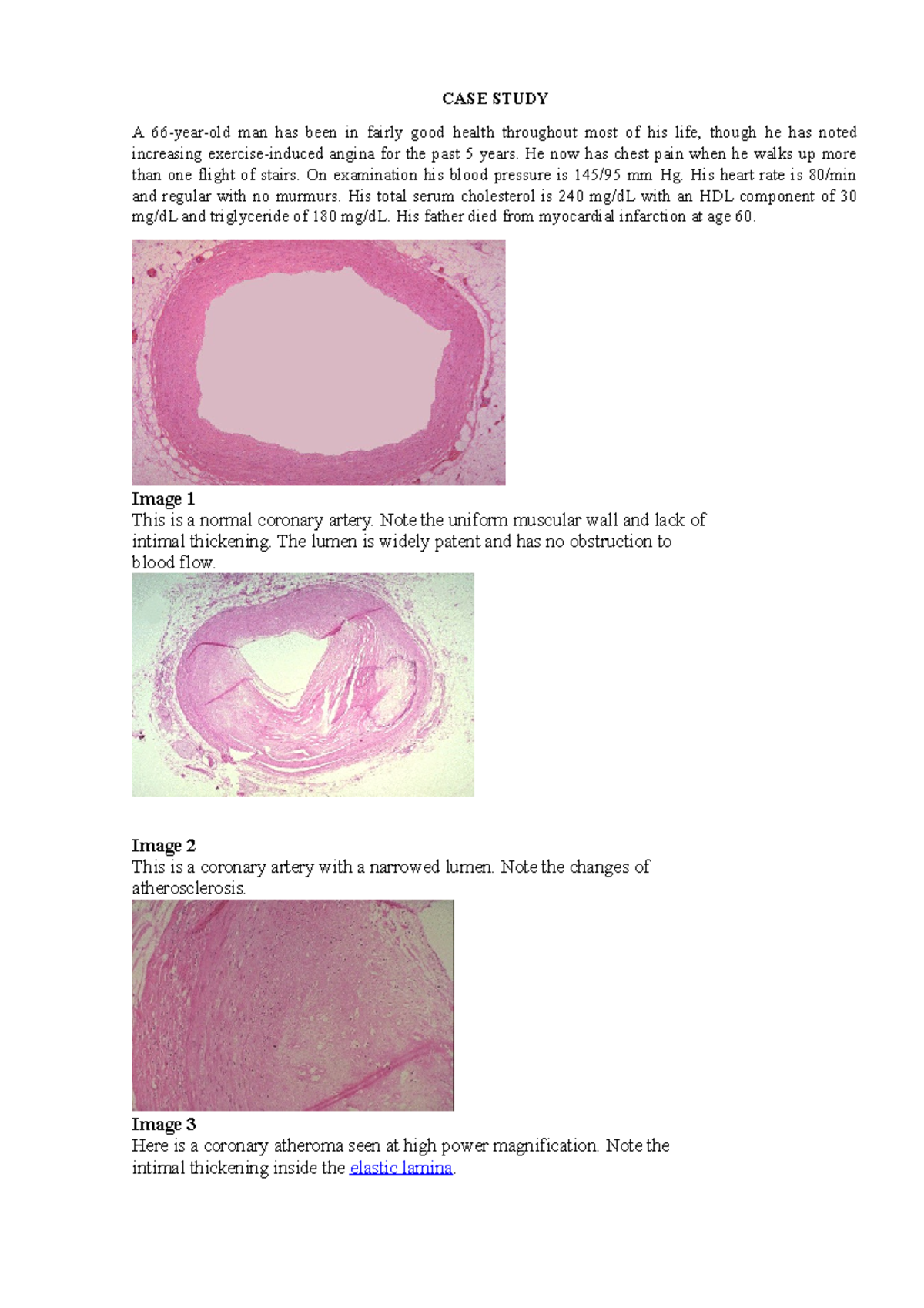 atherosclerosis case study pdf