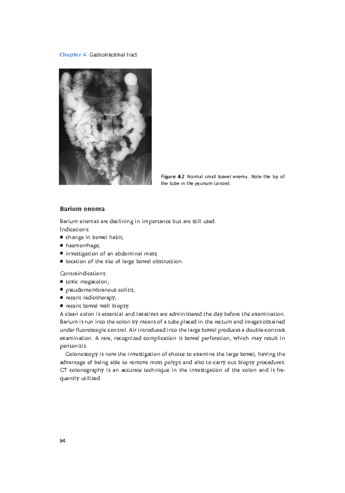 Radiology Lecture Notes Pdf (32) - Chapter 4 Gastrointestinal Tract 94 ...