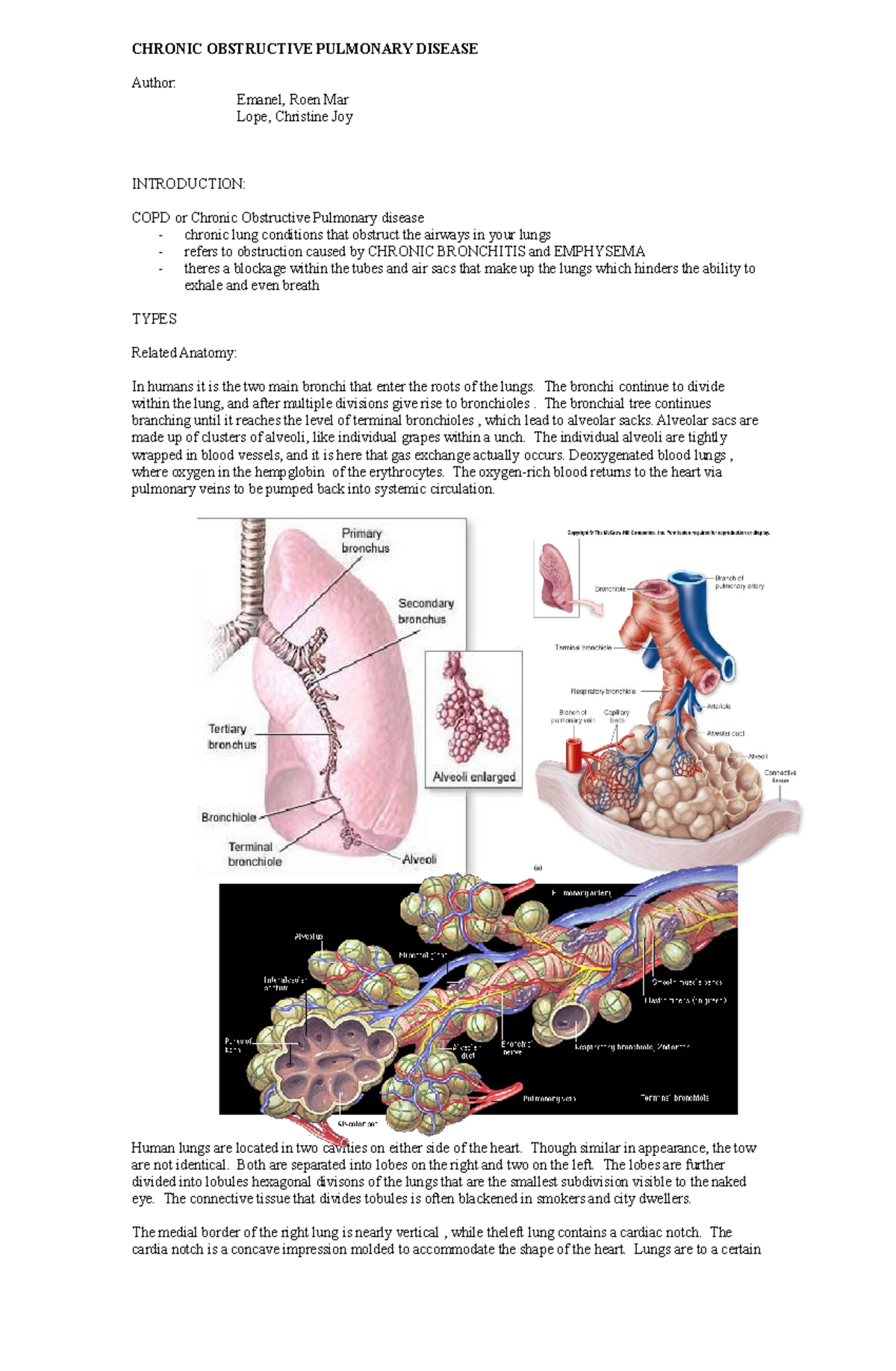 Copd - IDEAL - CHRONIC OBSTRUCTIVE PULMONARY DISEASE Author: Emanel ...