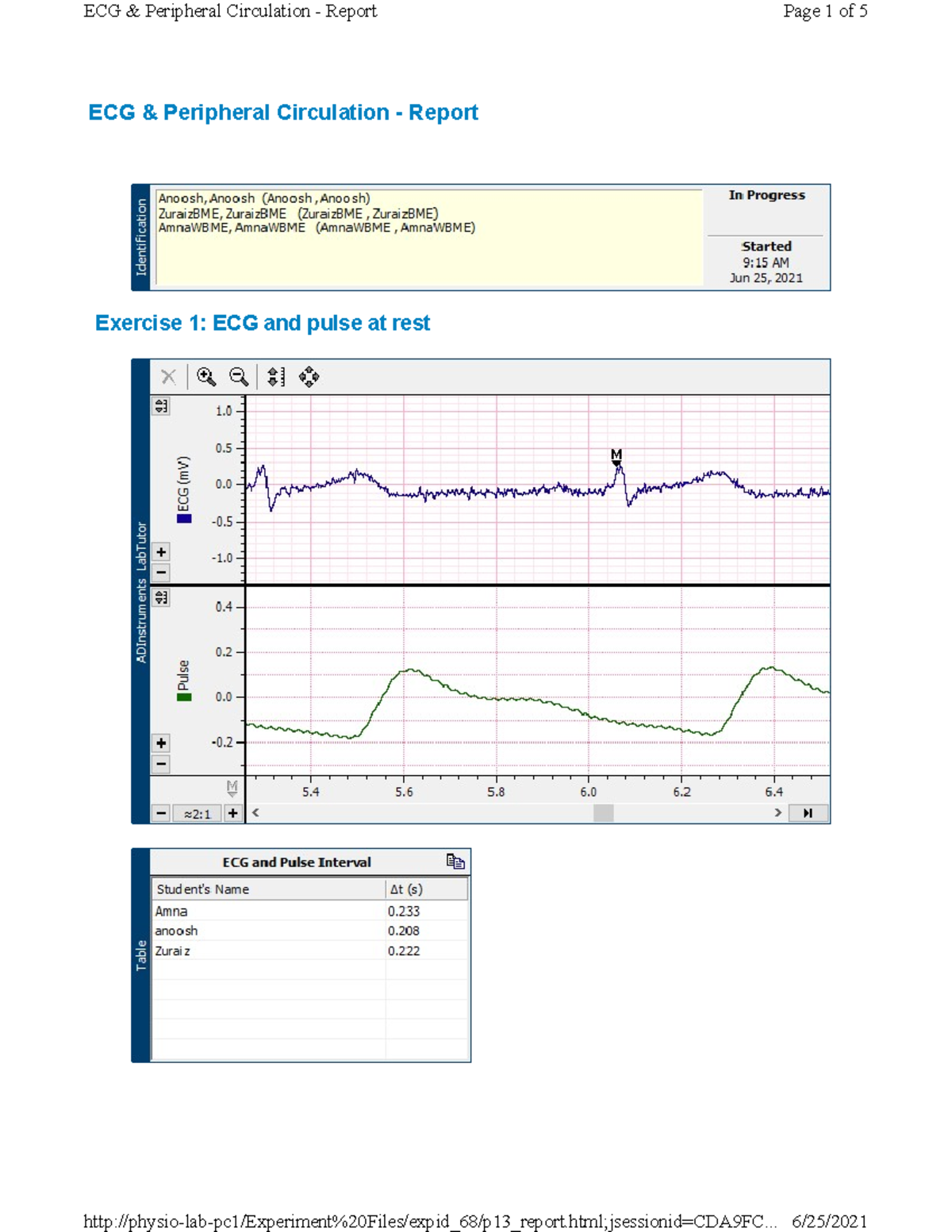 Lab 10 - Lab Questions - A lab regarding the powerlab equipment - ECG ...