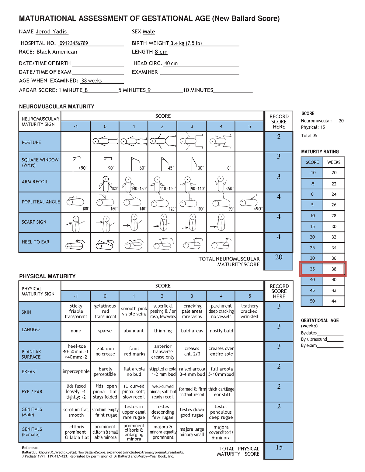 Ballard Scoring Nursing MATURATIONAL ASSESSMENT OF GESTATIONAL AGE   Thumb 1200 1553 