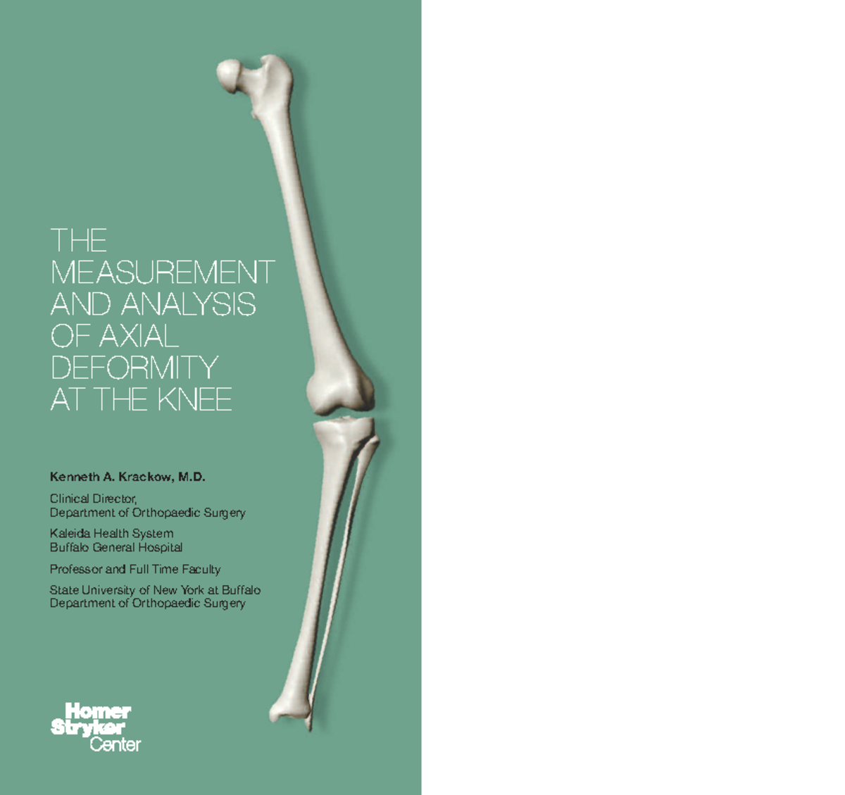 How to Measure Knee Alignment 220916 173828 - Kenneth A. Krackow, M ...