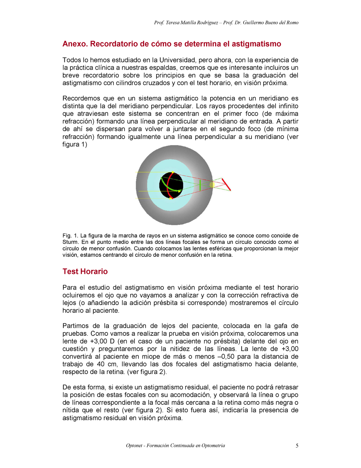 Determinaci N Del Astigmatismo En Cerca Anexo Recordatorio De C Mo Se Determina El