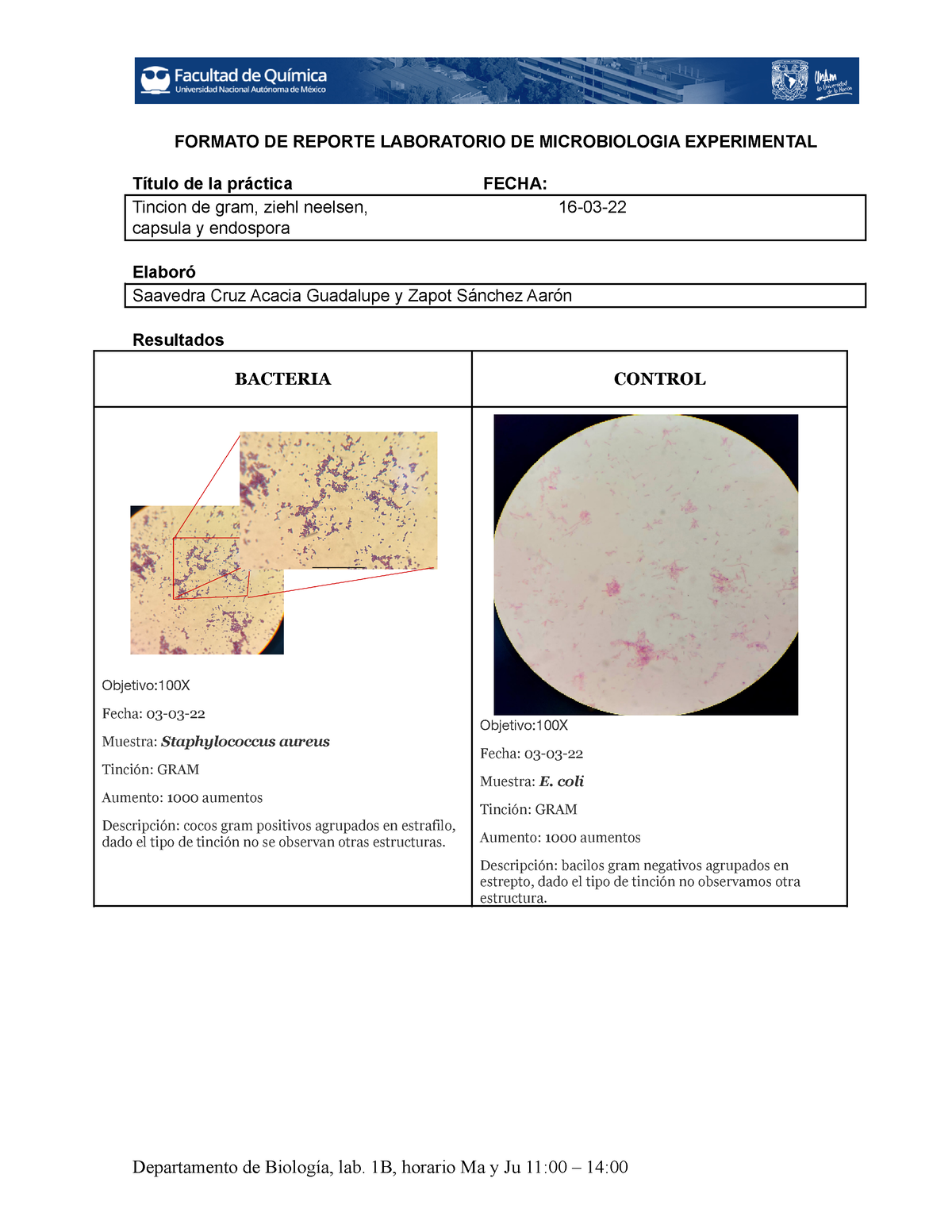 Staphylococcus aureus tinción de Gram