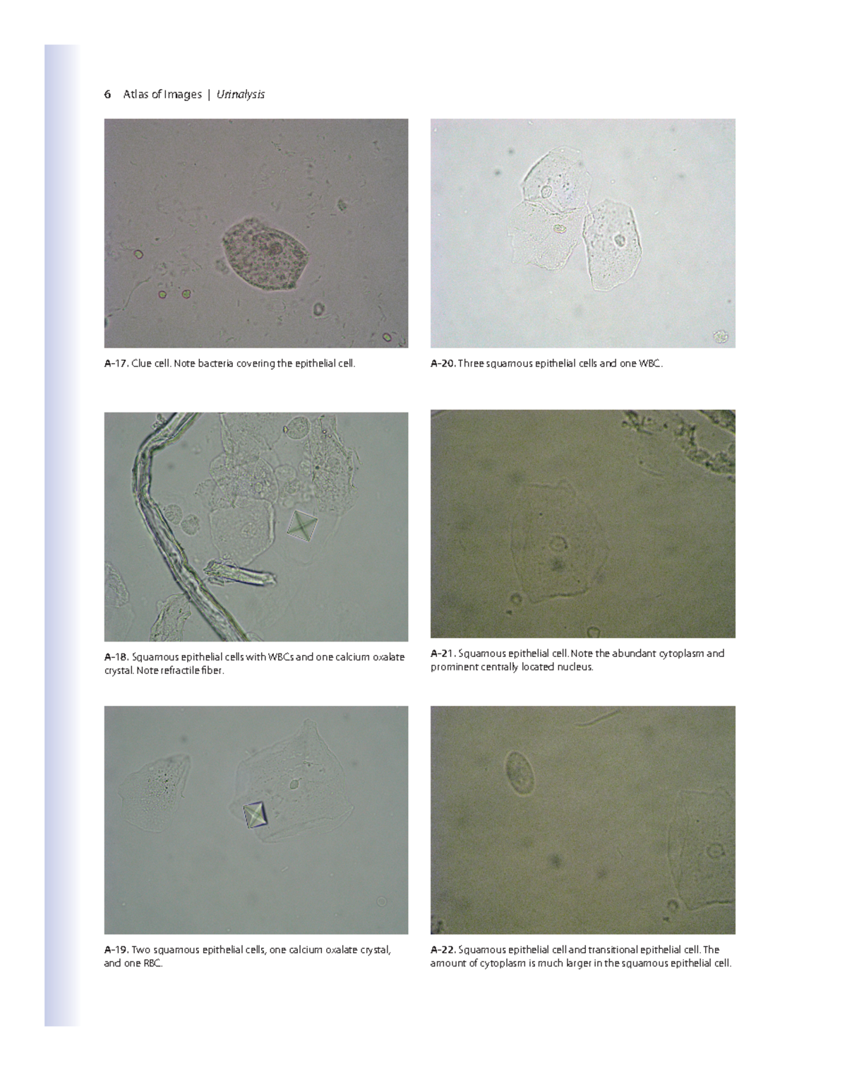 Analysis of Urine Notes 6 - 6 Atlas of Images | Urinalysis A-17. Clue ...