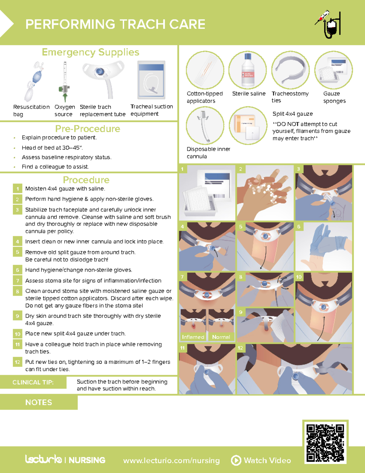 Review Sheet Performing Trach Care Nursing - lecturio/nursing Watch ...