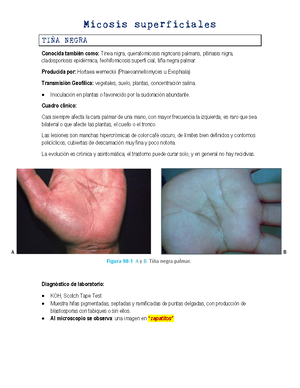 ^N9 Hidrosadenitis - Sinonimia Golondrinas o apocrinitis. DefiniciÛn ...