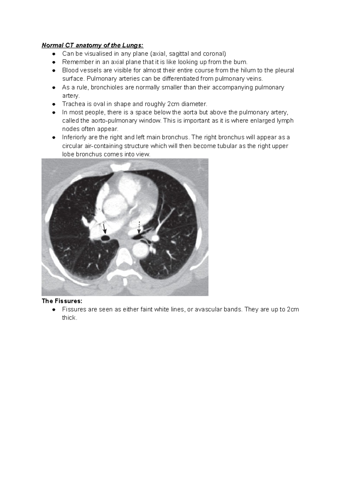 Chest CT - Lecture notes Year 4 Radiology - Normal CT anatomy of the ...