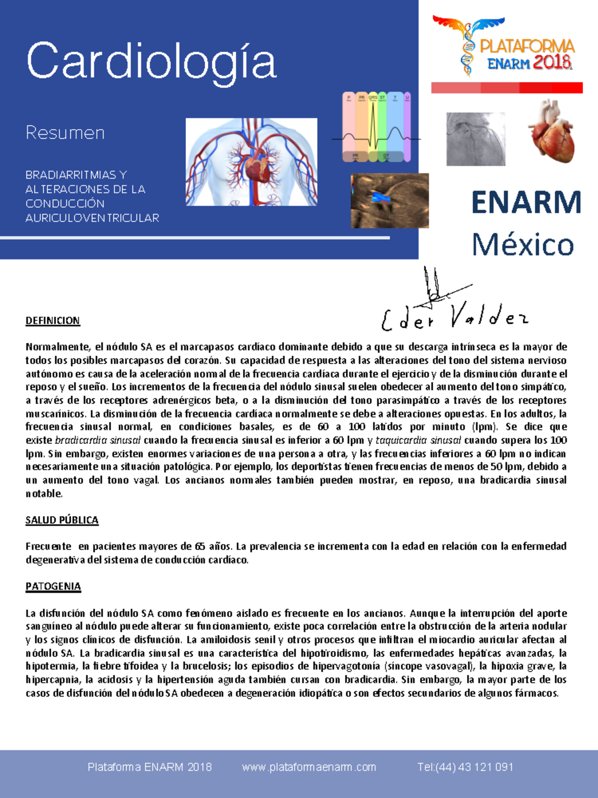 Cardiologia Resumen ENARM México Cardiología! Resumen BRADIARRITMIAS