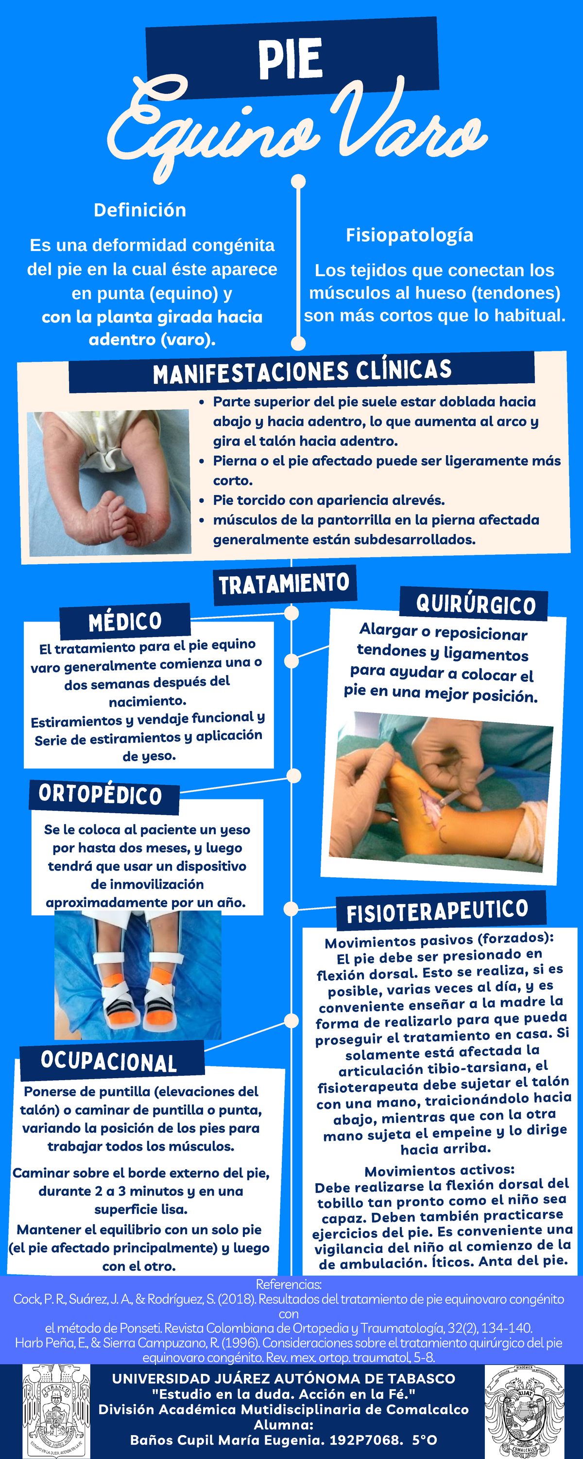 BañosCupilMariaEugenia5°O.Act.7. Infografía. Pie Equinovaro