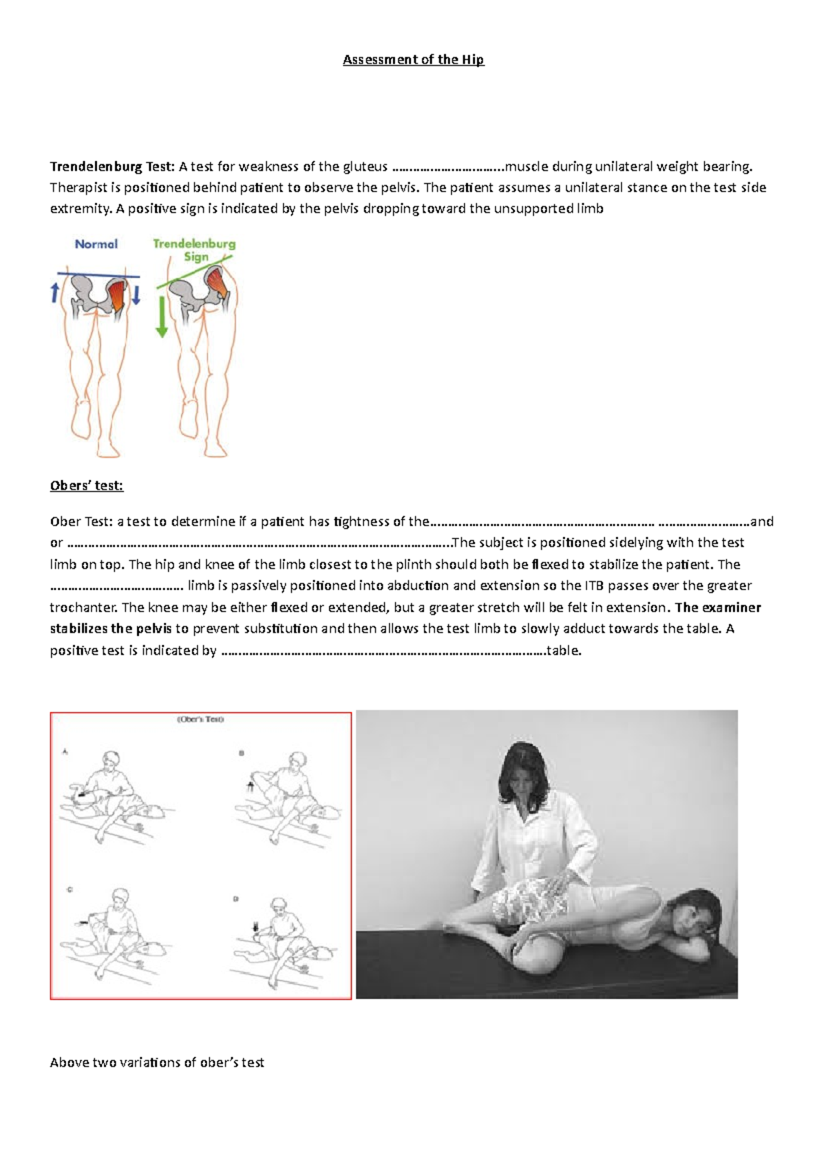 Hip special tests - Assessment of the Hip Trendelenburg Test: A test ...