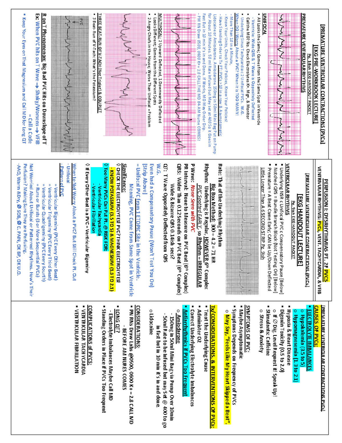 Perfusion I Dysrhythmias PVC - [PREMATURE VENTRICULAR CONTRACTIONS ...