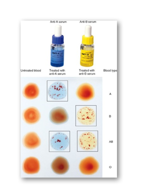BIOS255+Week+7+-+Respiratory+Physiology+Worksheet - What is normal ...