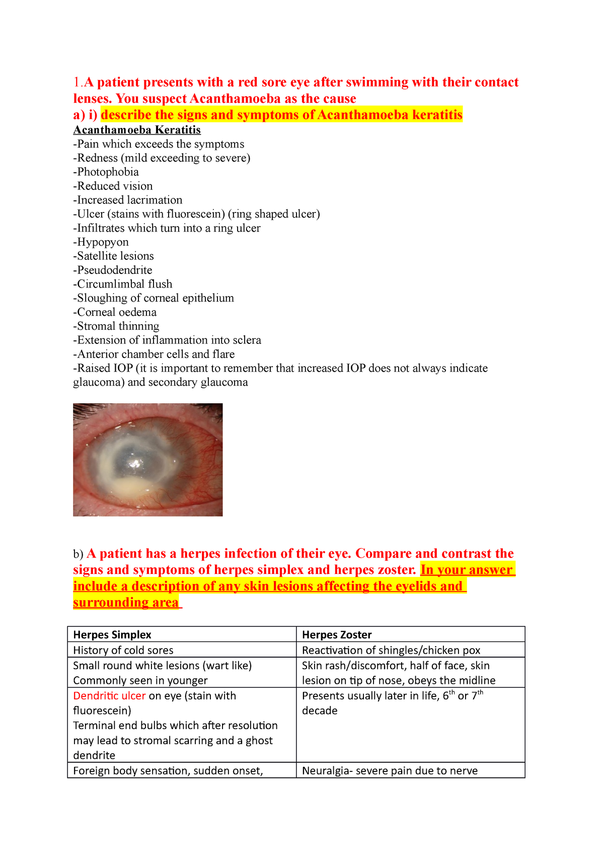 keratitis-revision-notes-1-patient-presents-with-a-red-sore-eye