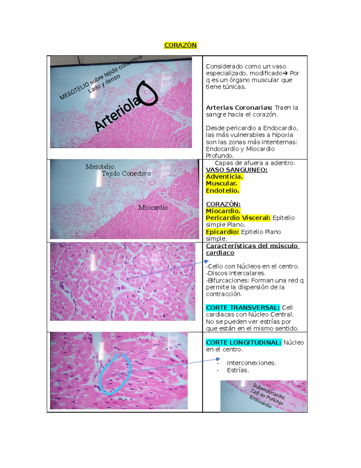 Histología De Corazón CorazÓn Considerado Como Un Vaso Especializado Modificado Por Q Es Un