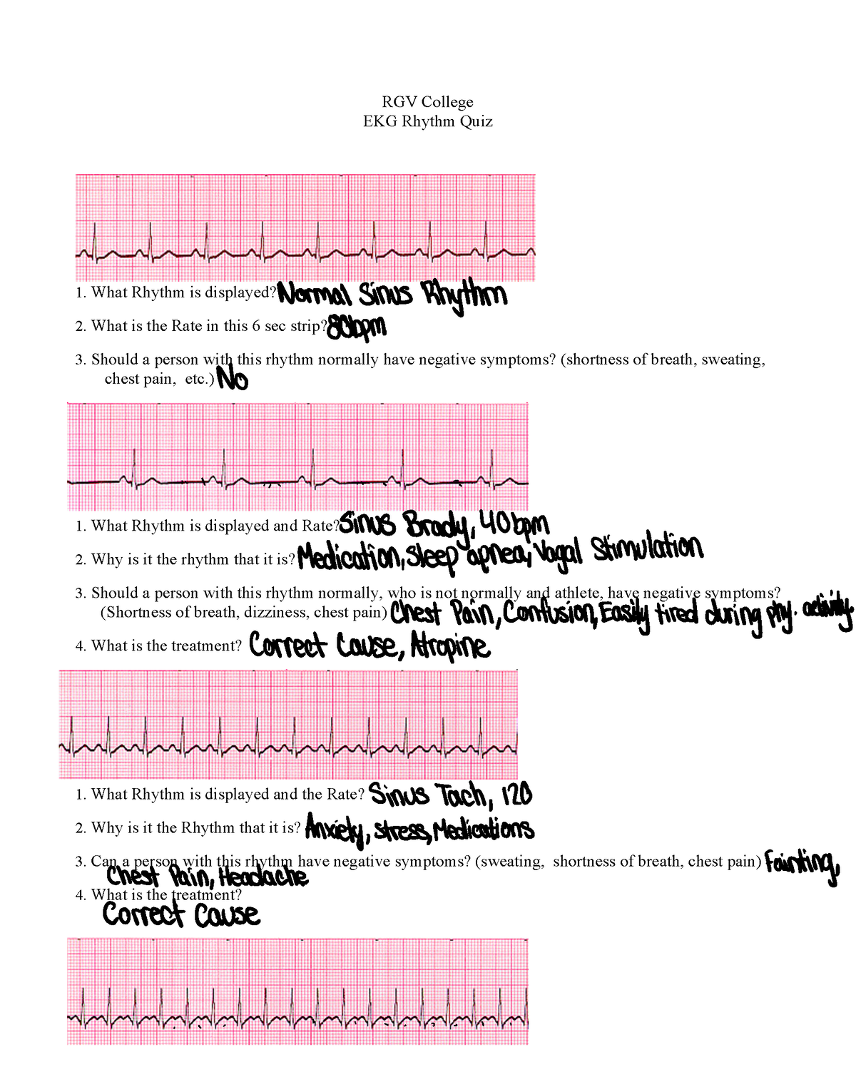 CH 48 EKG Quiz 1 - notes - RGV College EKG Rhythm Quiz 1. What Rhythm ...