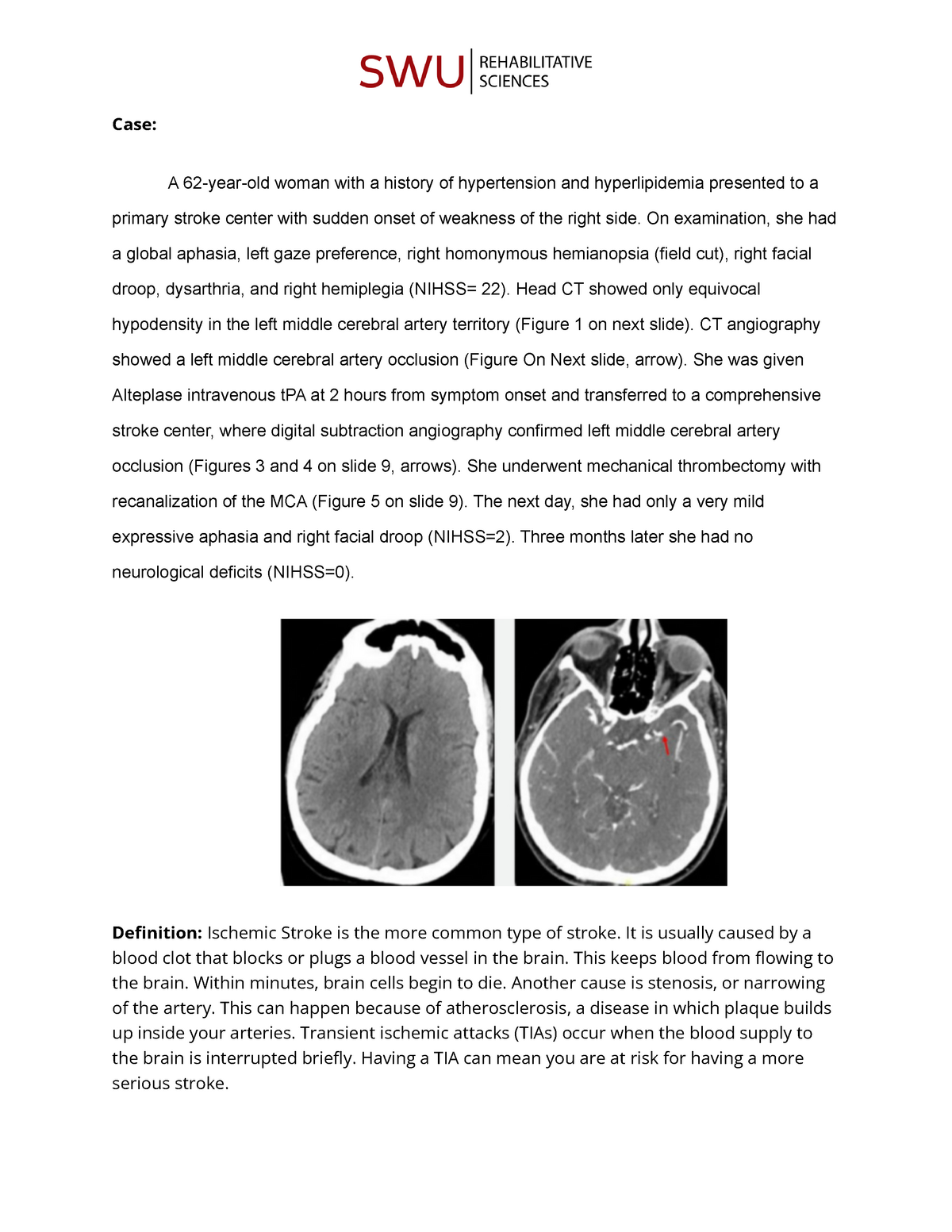 week-4-cva-ie-bs-psych-et-bs-pt-case-a-62-year-old-woman-with-a